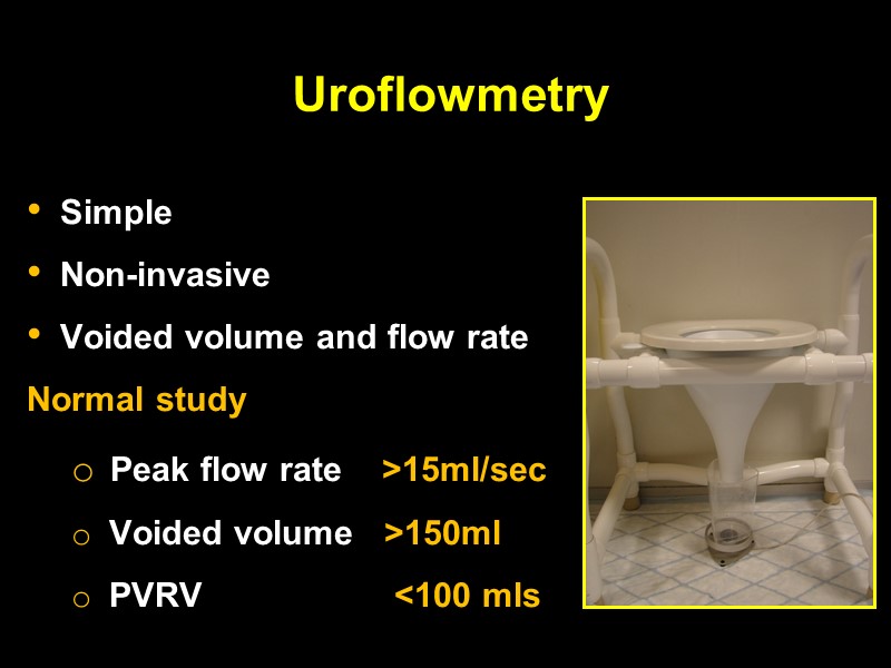 Uroflowmetry   Simple Non-invasive Voided volume and flow rate Normal study  